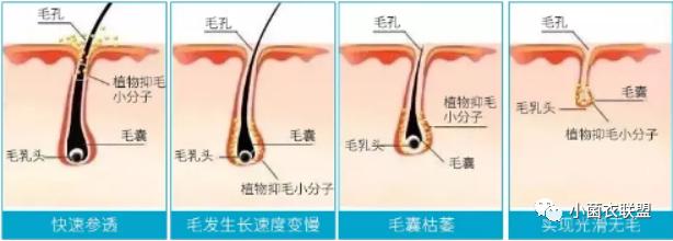 皮肤汗毛科普,皮肤疾病健康科普