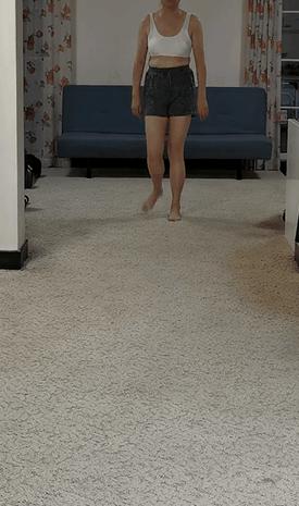 大腿内旋走路矫正,体态矫正走路