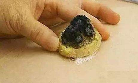 每天艾灸肚子和腰对妇科有好处吗,艾灸在妇科中的功效与作用