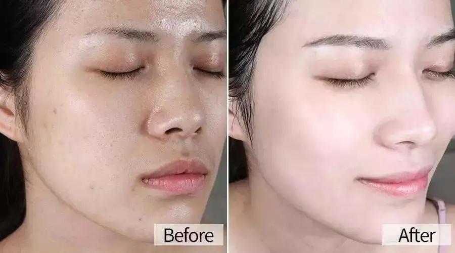 做医美的女生有多少,做医美的女生有什么特征