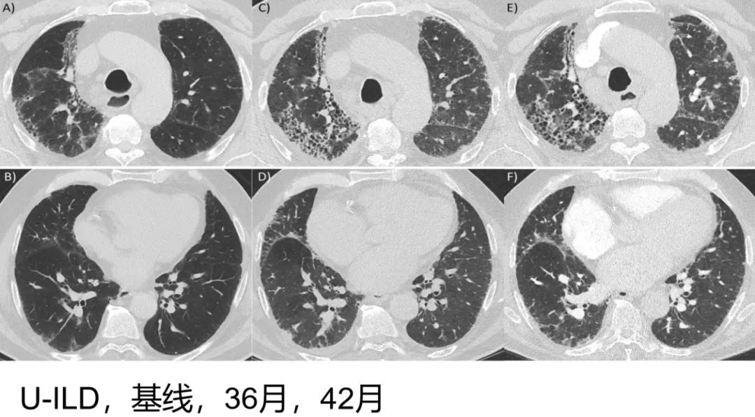 代华平视频,中日友好医院代华平