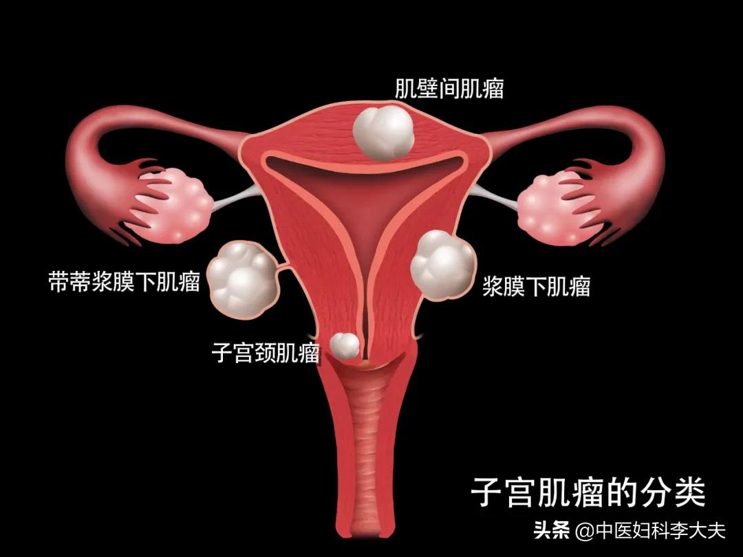 子宫增大了，会是什么原因呢？