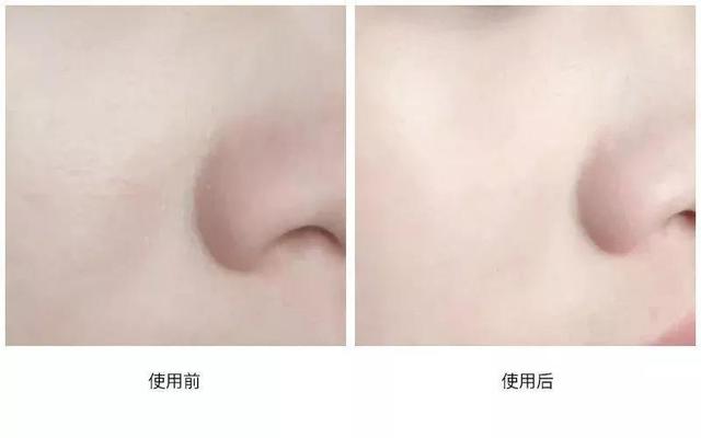 澳洲绵羊油哪款补水保湿效果好,澳大利亚哪个牌子绵羊油滋润保湿