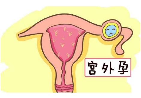 孕期出血别惊慌看看真相是什么,孕期出血怎么办专家教你正确应对