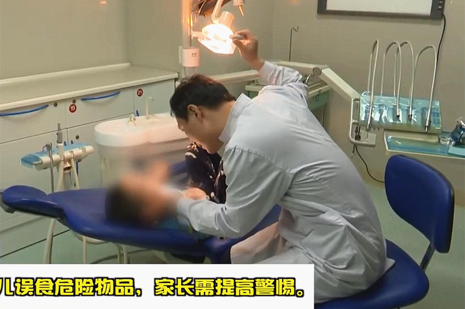 一岁半宝宝误食502胶,好在妈妈淡定处理,医生:妈妈机智