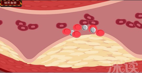 高血压对身体的危害你知道多少,高血压对人体有什么影响和危害