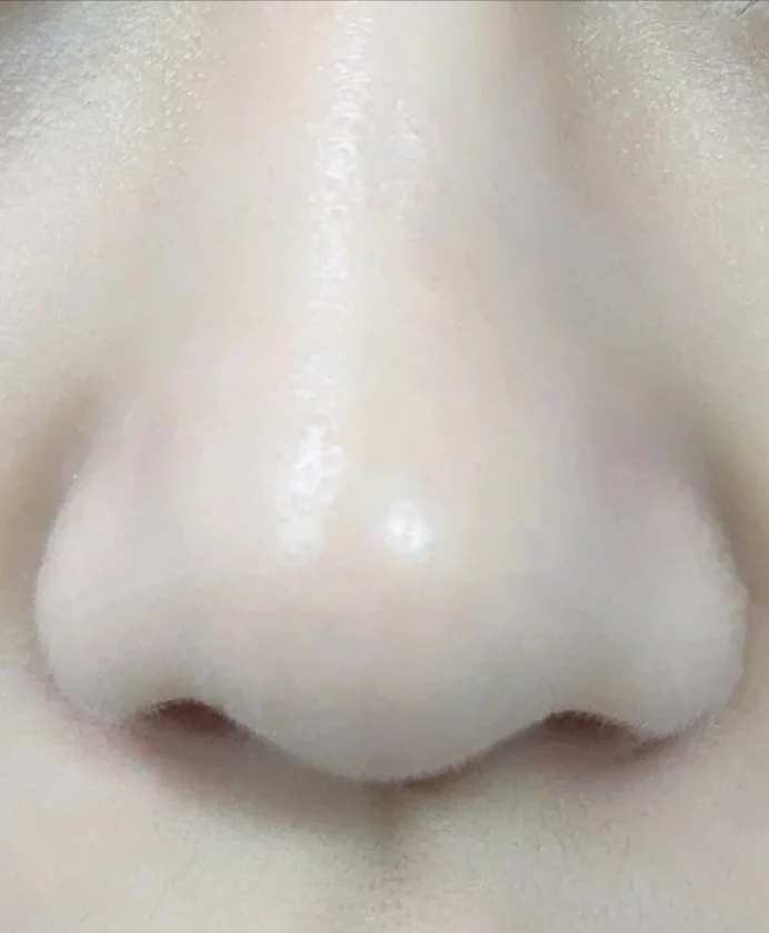 去黑头不伤皮肤的最好方法,去黑头不伤皮肤的最有效方法