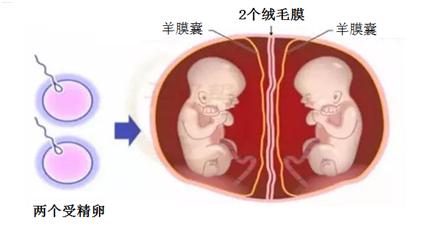 两个胎盘的双胞胎是同卵还是异卵,双胞胎一个胎盘有几条脐带