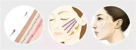 年轻人的抗老精华,用了惊艳的抗老精华