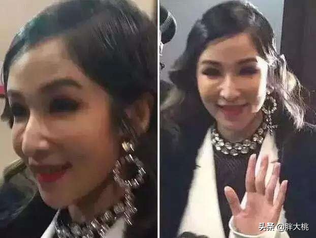 透明质酸和玻尿酸有什么区别,透明质酸跟玻尿酸是一个东西吗