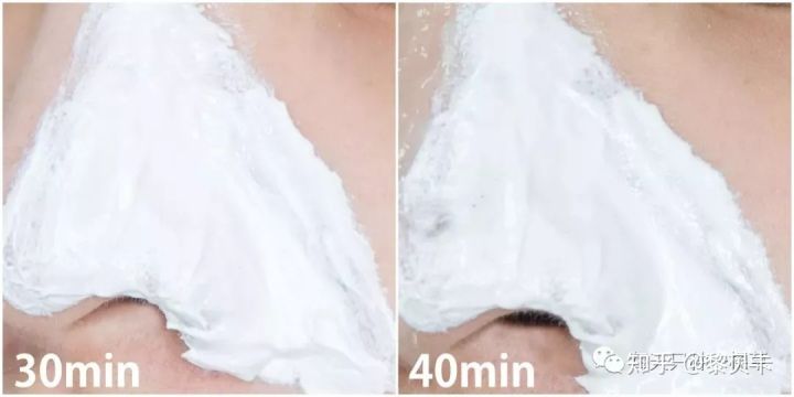 公认最好用的去黑头神器,网红推荐去黑头神器