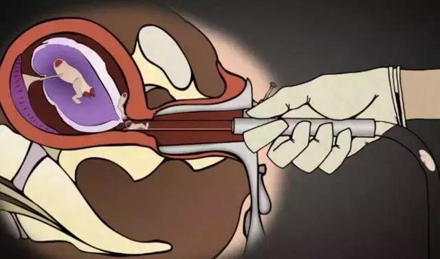 丁嘉丽明星的故事,丁嘉丽央视