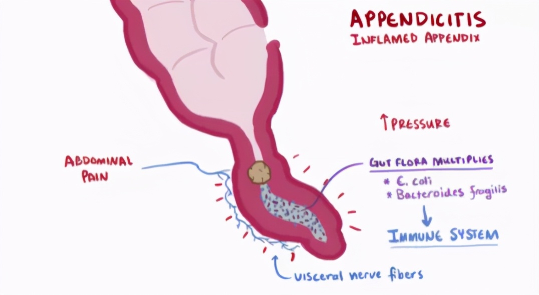 宝宝肚子疼不能大意,宝宝肠胃炎会肚子痛吗
