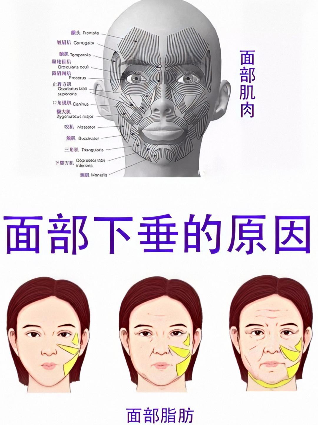 不做拉皮怎么能把脸上皱纹解决了,28岁脸皮松弛皱纹多怎么办