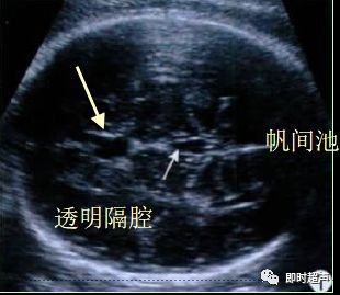 产科常规彩色超声报告单介绍,常见妇科疾病超声报告