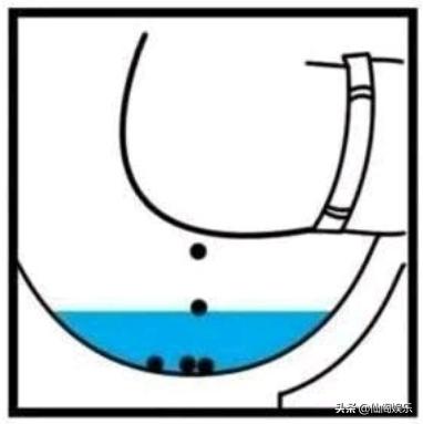 大便的时候总是溅到身上,大便时厕所水溅上来怎么办