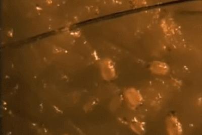 被痘痘践踏的自尊心有救了,坚持做好这五点,让你找回自信!