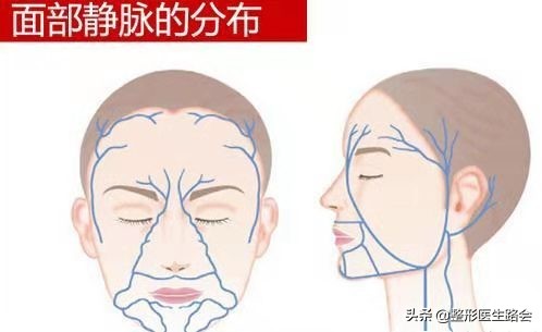 挤黑头鼻头大会变小,挤黑头鼻头会越来越大吗