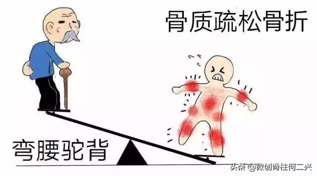 精准穿刺外科技术取代“开刀手术”治疗骨质疏松椎体骨折