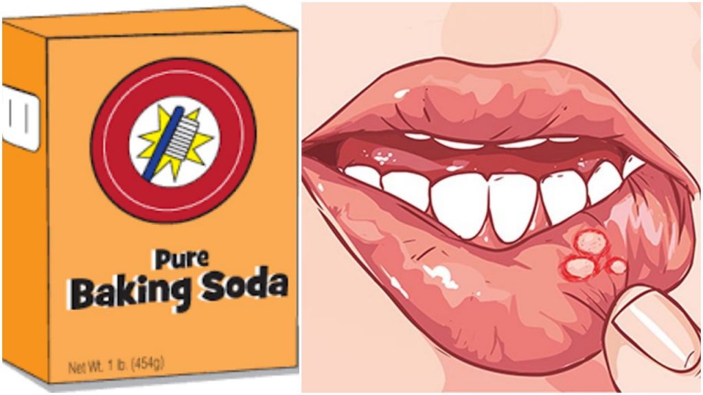 小苏打的四个妙用你记住了吗,你知道小苏打的妙用有多少吗