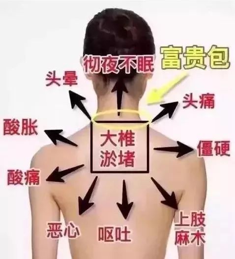 给脖子按摩如何缓解脖子上的酸痛,脖子后面颈椎肉很厚怎么按摩