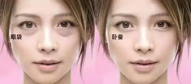 肾虚眼袋黑脾虚眼袋大图片,脾虚肾虚导致的眼袋大怎么办