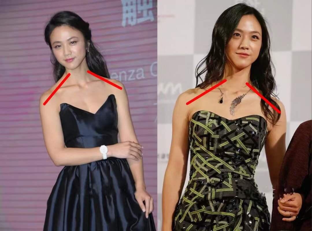 溜肩严重的明星,溜肩毁身材4招帮你改善圆肩