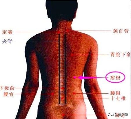 夏天艾灸好还是冬天艾灸好,春天艾灸好还是夏天艾灸好