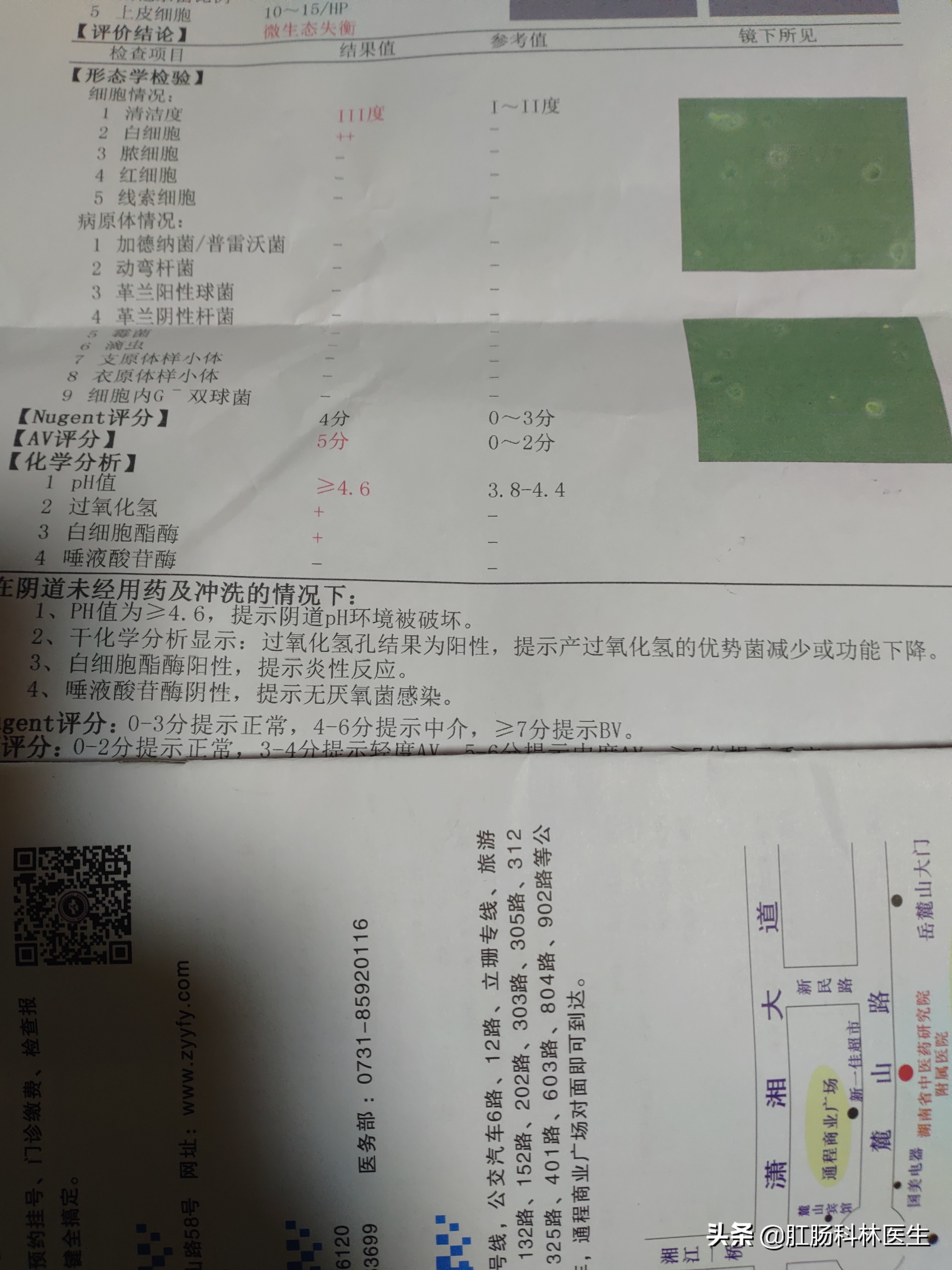 宫颈糜烂二度要不要做leep刀手术,宫颈糜烂做leep刀手术的利弊