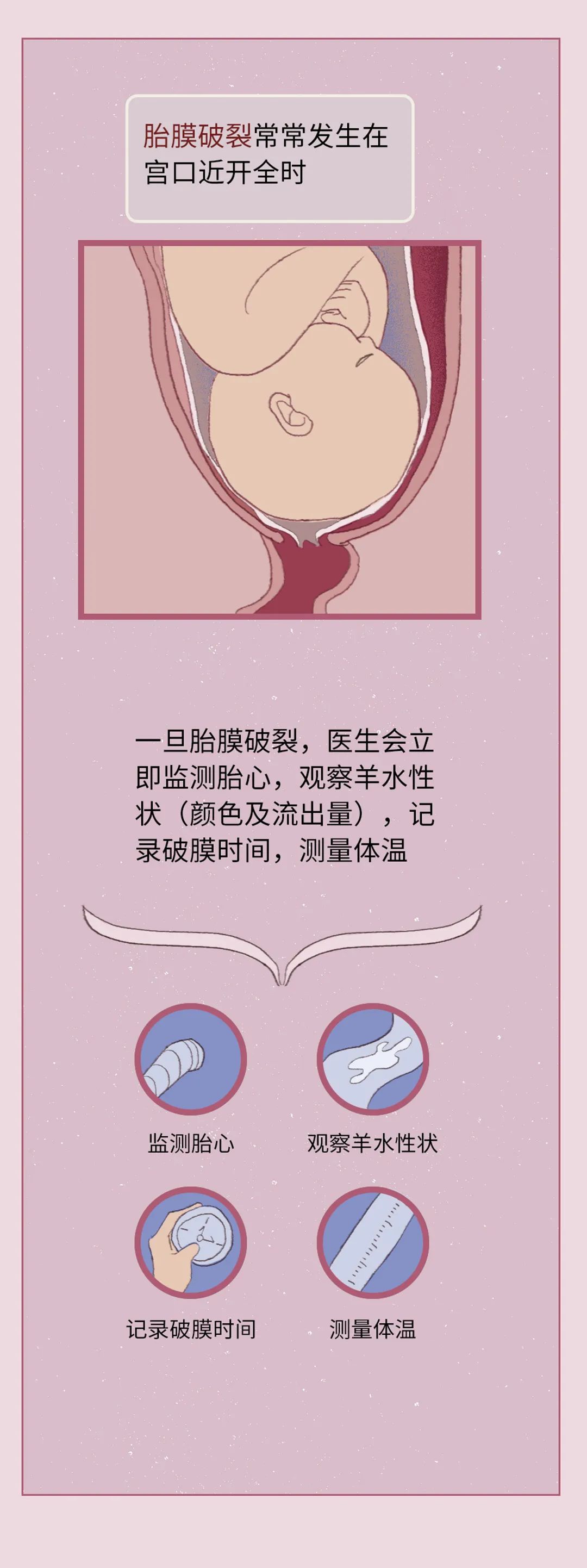 顺产过程简介,女人顺产后最痛苦的过程