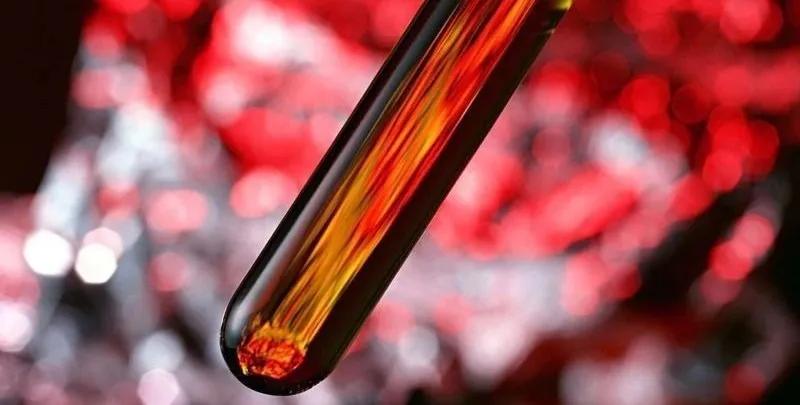 尿常规中白细胞123,尿检白细胞118多严重吗