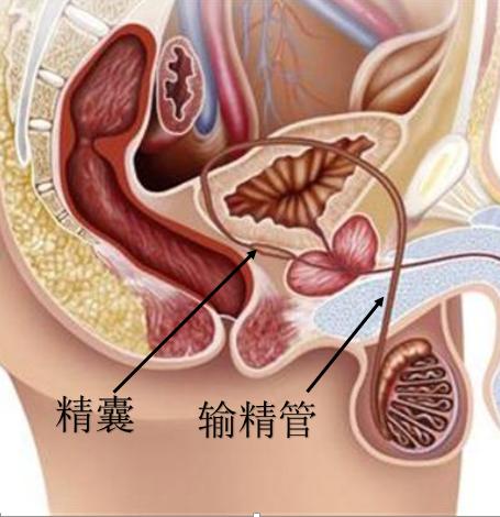 精子带血怎么回事呀,精子带血咋回事啊