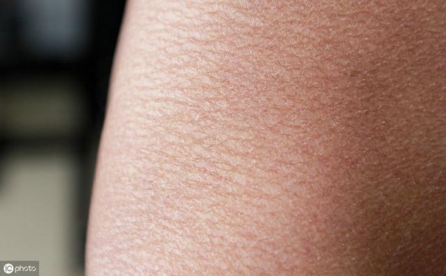 皮肤干燥起皮用什么身体乳好,冬季皮肤严重起皮用什么身体乳好