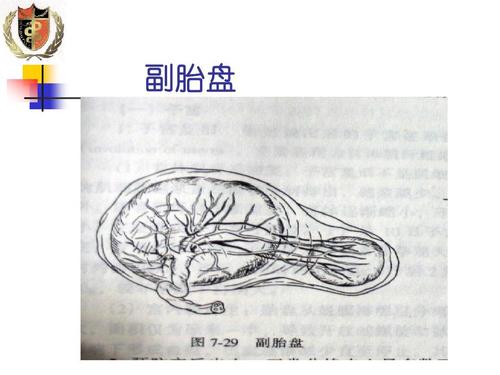 产检显示胎盘低很严重吗,有两个胎盘但是是单胎是什么原因