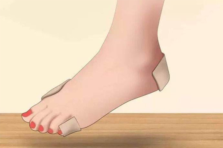 鞋子磨脚后跟怎么办抹牙膏,创可贴贴脚趾踢球可以避免磨脚吗