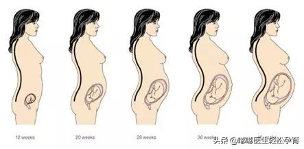 坐月子后有痛风用什么药治,坐月子后痛风怎么治疗