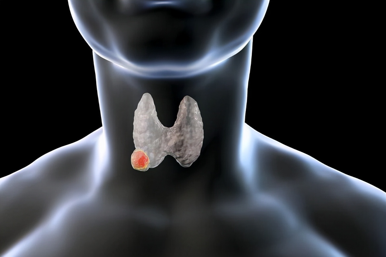 喝蒲公英消除结节是真还是假,五十岁大姐喝蒲公英消结节