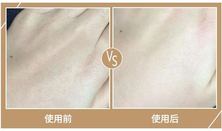 秋冬手干裂擦手霜,冬天手脚干裂涂什么护肤品