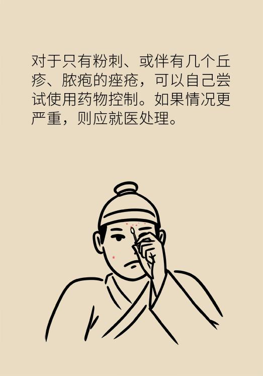 协和医院教你祛痘,长痘别着急中医祛痘秘方来帮你