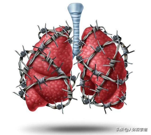 山东齐鲁医院百草枯中毒治好案例,齐鲁医院百草枯救活有多少案例