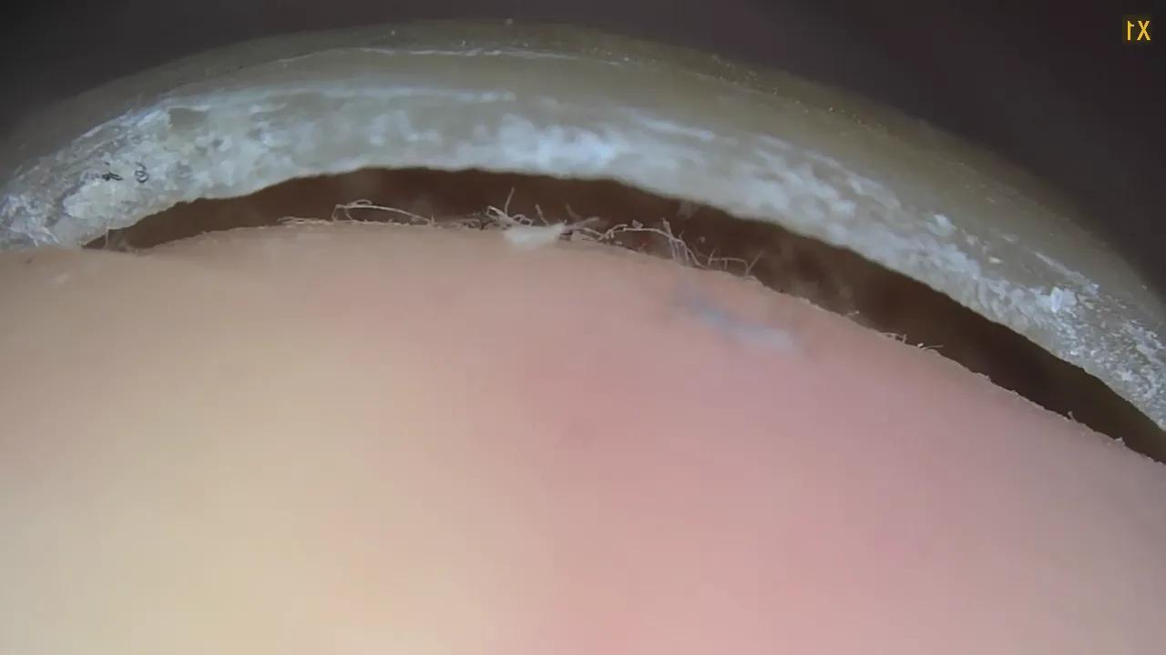 专家教你正确剪指甲的方式,正常指甲怎么修剪为健康