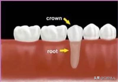 牙掉了装回去后需要注意什么,自己的牙掉了还能装回去吗