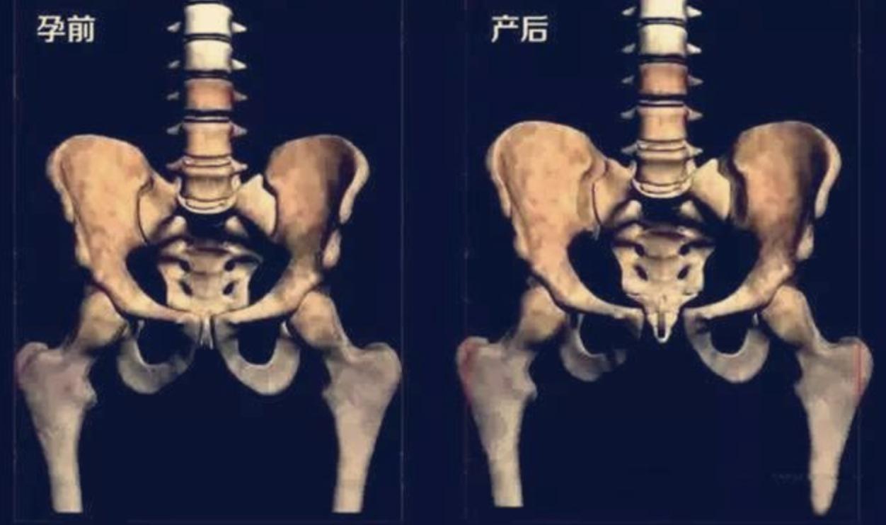 孕妈多少个月肚子才显大,孕妈的肚子又大又圆