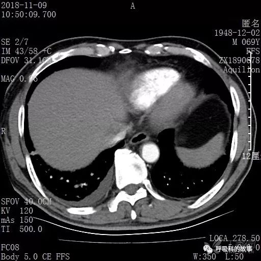 怎么应用统计学做调查,统计学方法可以解决的主要问题