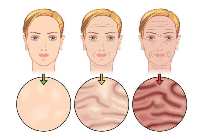睡觉不卸妆，容易造成这4种严重后果，你卸妆了吗？