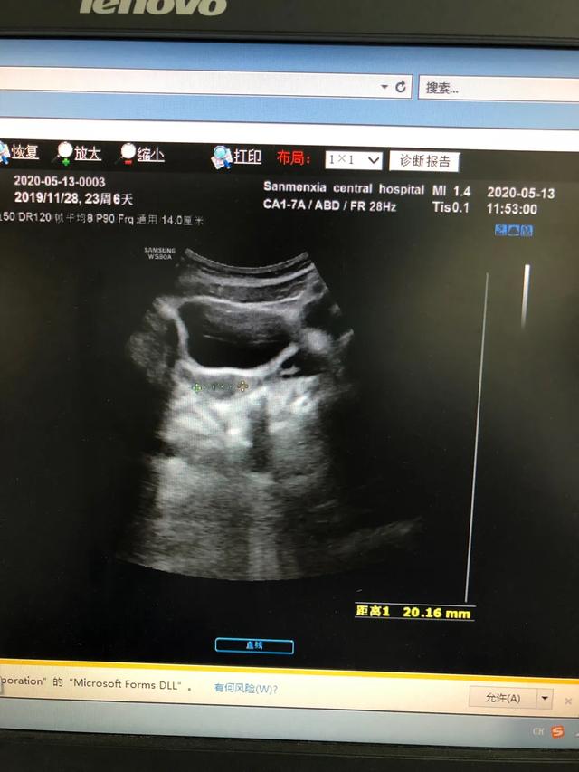 儿童性早熟要做哪些检查？怎么根据这些指标判断真性还是假性？