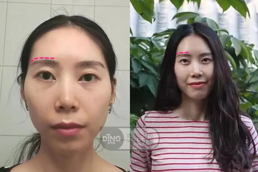 圆胸练成方胸的方法,圆身平胸怎么办