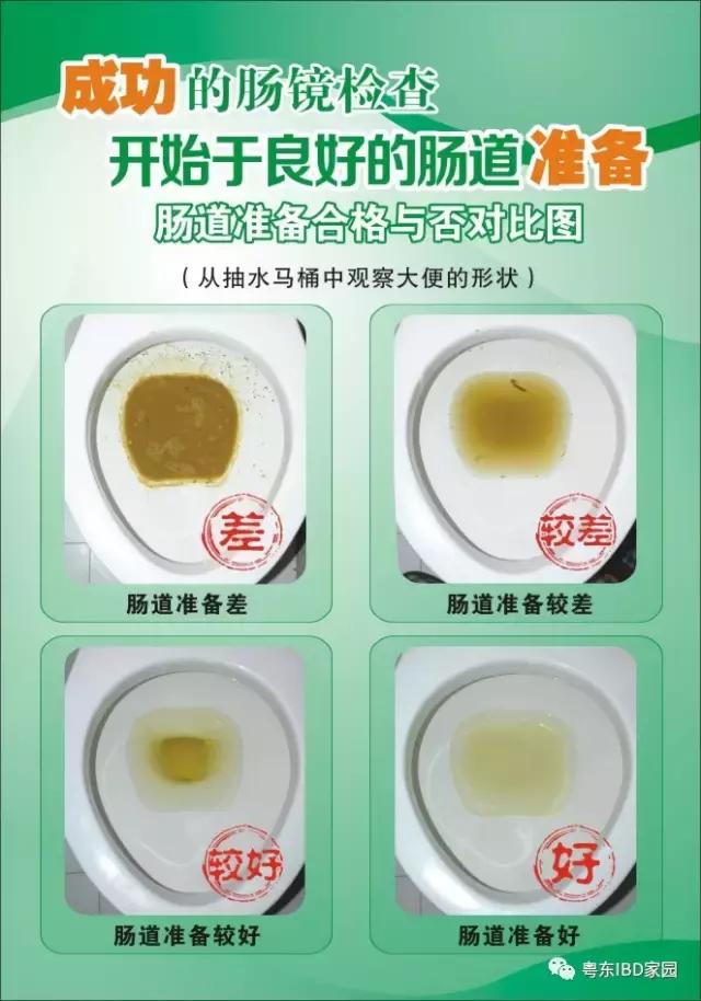 内窥镜胶囊检查效果怎么样,胶囊内窥镜