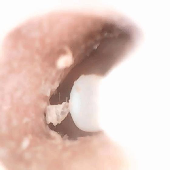 让你能看得见的掏耳朵“粑粑”，蜂鸟智能可视采耳棒M9Pro