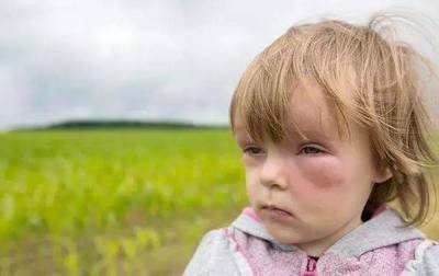 灭蚊黑科技四合一手持灭蚊器,新型智能灭蚊器